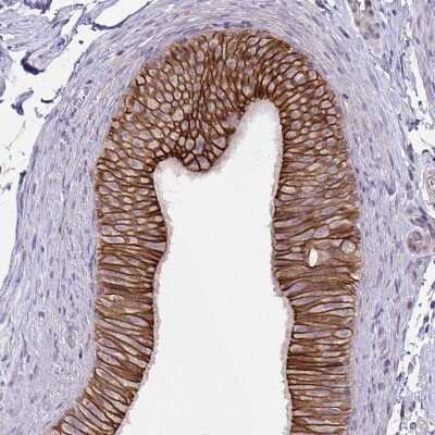 Immunohistochemistry-Paraffin: ARVCF Antibody [NBP2-38999]