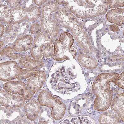 Immunohistochemistry-Paraffin: ARVCF Antibody [NBP2-38999]