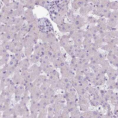Immunohistochemistry-Paraffin: ARVCF Antibody [NBP2-38999]