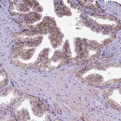 Immunohistochemistry-Paraffin: ARVCF Antibody [NBP2-38999]