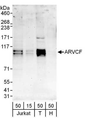 Western Blot: ARVCF Antibody [NBP1-78213]