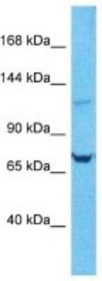 Western Blot: ARVCF Antibody [NBP3-10661]