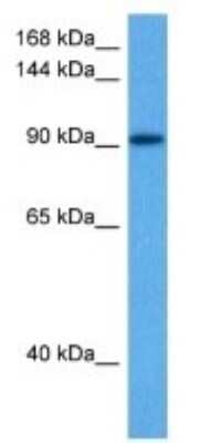 Western Blot: ARVCF Antibody [NBP3-10815]