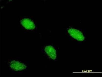 Immunocytochemistry/ Immunofluorescence: ARX Antibody (1G11) [H00170302-M03]