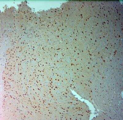Immunohistochemistry-Paraffin: ARX Antibody [NBP2-80506]