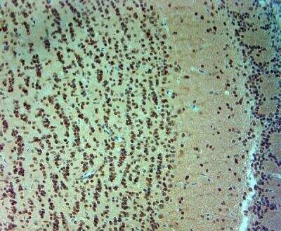 Immunohistochemistry-Paraffin: ARX Antibody [NBP2-80506]