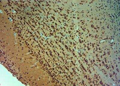 Immunohistochemistry-Paraffin: ARX Antibody [NBP2-80506]