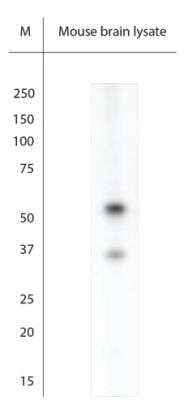 Western Blot: ARX Antibody [NBP2-80506]