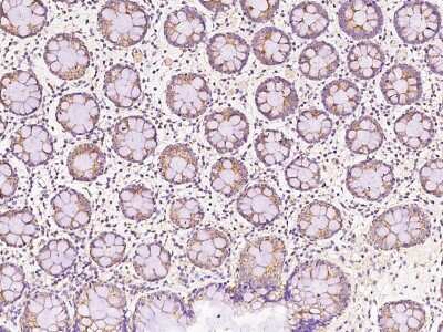 Immunohistochemistry-Paraffin: AS3MT Antibody [NBP2-97425]