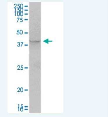 Western Blot: AS3MT Antibody [H00057412-B01P-50ug]