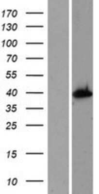 Western Blot: AS3MT Overexpression Lysate [NBP2-06623]