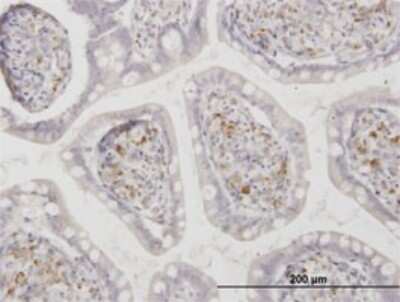 Immunohistochemistry-Paraffin: ASAH1 Antibody (1A7) [H00000427-M02]