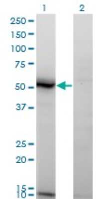 Western Blot: ASAH1 Antibody (1A7) [H00000427-M02]