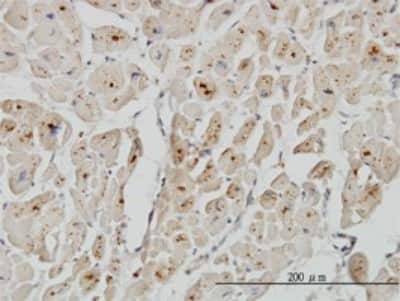 Immunohistochemistry-Paraffin: ASAH1 Antibody (2C9) [H00000427-M01]