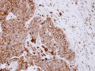 Immunohistochemistry-Paraffin: ASAH1 Antibody [NBP2-15479]