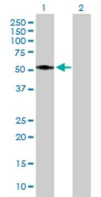 Western Blot: ASAH1 Antibody [H00000427-D01P]