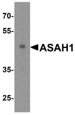 Western Blot: ASAH1 AntibodyBSA Free [NBP1-76933]