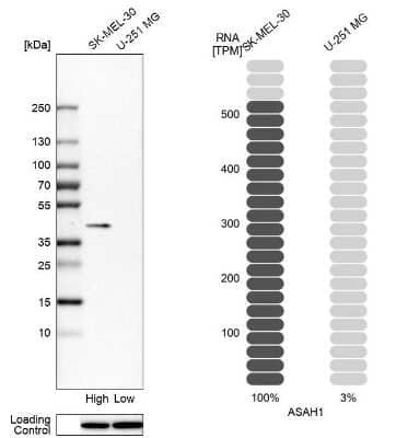 Western Blot: ASAH1 Antibody [NBP1-89296]