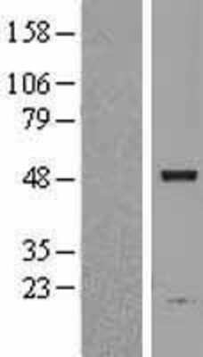 Western Blot: ASAH1 Overexpression Lysate [NBL1-07747]