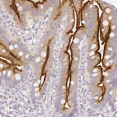 Immunohistochemistry-Paraffin: ASAH2/N-acylsphingosine Amidohydrolase-2 Antibody [NBP2-49326]