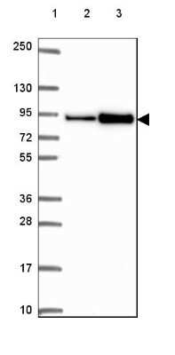 Western Blot: ASAH2/N-acylsphingosine Amidohydrolase-2 Antibody [NBP2-49326]