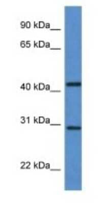 Western Blot: ASAH3 Antibody [NBP1-74125]