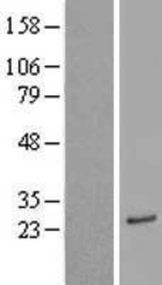 Western Blot: ASAH3 Overexpression Lysate [NBL1-07748]