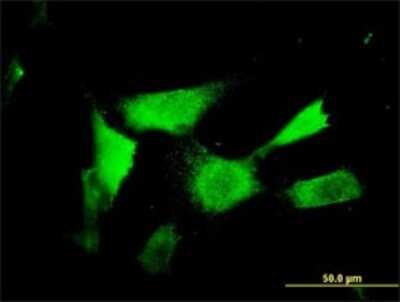 Immunocytochemistry/ Immunofluorescence: ASAHL/N-acylethanolamine-hydrolyzing Acid Amidase Antibody (5E3) [H00027163-M01]