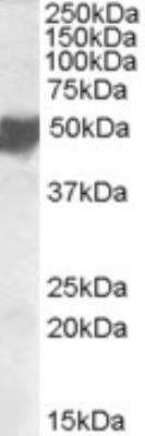 Western Blot: ASAM Antibody [NBP1-44065]