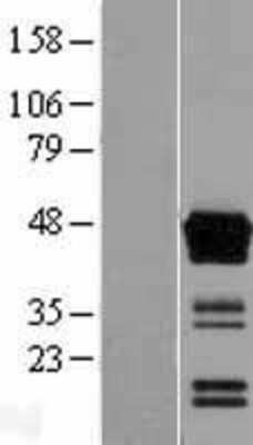 Western Blot: ASAM Overexpression Lysate [NBL1-07749]