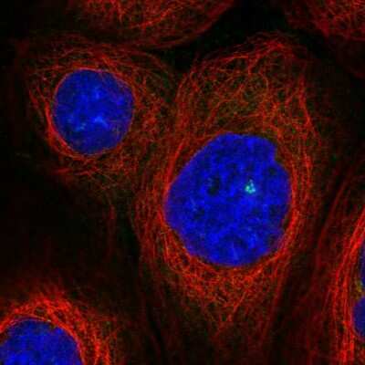 Immunocytochemistry/ Immunofluorescence: ASAP1 Antibody [NBP2-48909]
