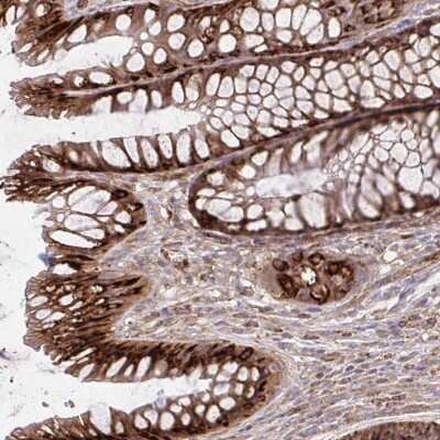 Immunohistochemistry-Paraffin: ASAP1 Antibody [NBP2-48519]
