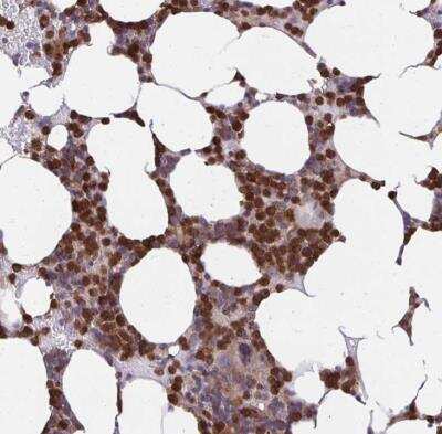 Immunohistochemistry-Paraffin: ASAP1 Antibody [NBP2-48909]