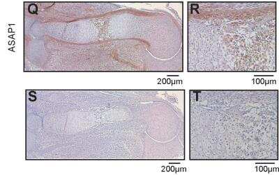 Knockout Validated: ASAP1 Antibody [NBP2-48909]