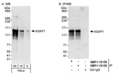 Western Blot: ASAP1 Antibody [NBP1-19159]