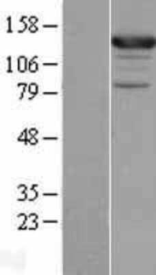 Western Blot: ASAP1 Overexpression Lysate [NBL1-09767]