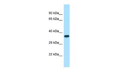 Western Blot: ASB-14 Antibody [NBP3-09563]