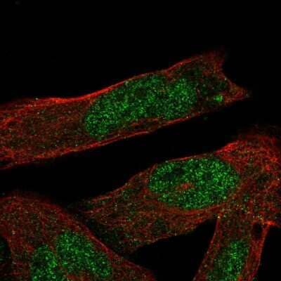 Immunocytochemistry/ Immunofluorescence: ASB1 Antibody [NBP1-89009]