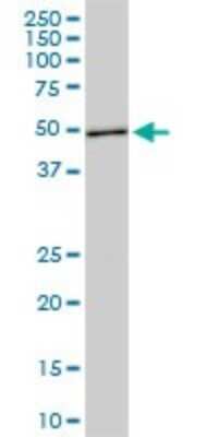 Western Blot: ASB10 Antibody (1F3) [H00136371-M02]
