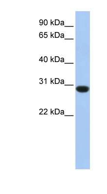 Western Blot: ASB12 Antibody [NBP1-70413]