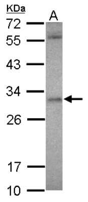 Western Blot: ASB12 Antibody [NBP2-15480]