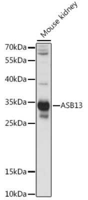 Western Blot: ASB13 AntibodyAzide and BSA Free [NBP2-92275]