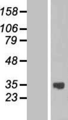 Western Blot: ASB13 Overexpression Lysate [NBP2-06302]