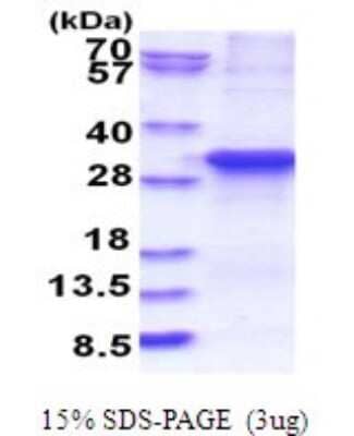 SDS-PAGE: Recombinant Human ASB13 His Protein [NBP2-51796]