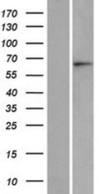 Western Blot: ASB15 Overexpression Lysate [NBP2-05744]