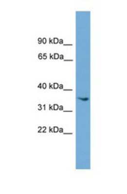 Western Blot: ASB17 Antibody [NBP1-57066]