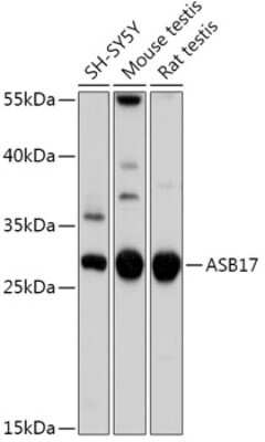 Western Blot: ASB17 AntibodyAzide and BSA Free [NBP2-92385]