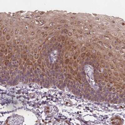 Immunohistochemistry: ASB18 Antibody [NBP2-49555]