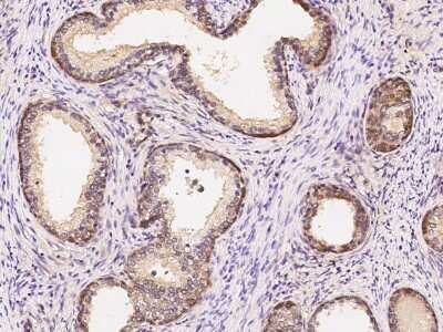 Immunohistochemistry-Paraffin: ASB2 Antibody [NBP2-98774]