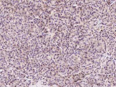 Immunohistochemistry-Paraffin: ASB2 Antibody [NBP2-98774]